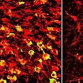 Reducir el 'colesterilo' controla el alzhéimer en ratones