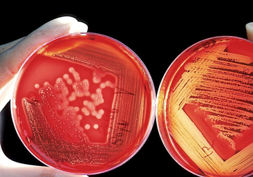 La OMS advierte que el uso indebido de antibióticos socava su eficacia