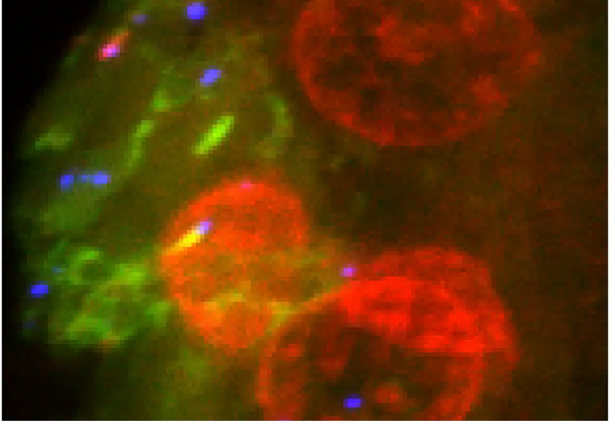 Células cancerosas en sangre