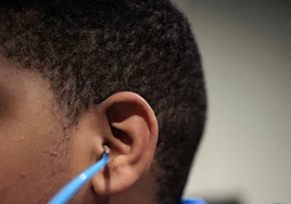 Seis niños sordos vuelven a oír con una terapia génica