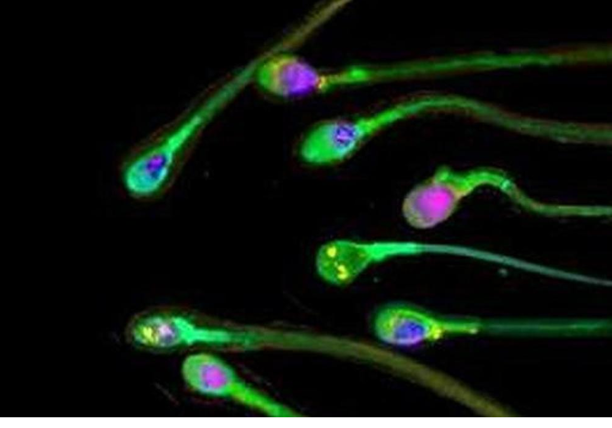 Espermatozoides 266% más rápidos y fértiles con ultrasonidos