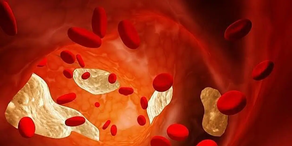 La thérapie épigénétique fait taire le gène du cholestérol chez la souris pendant un an