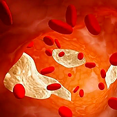 La terapia epigenética silencia el gen del colesterol en ratones durante un año