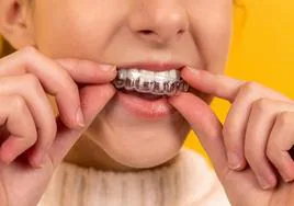 Tratamientos de ortodoncia por internet: ¿Son seguros y aconsejables para la salud bucodental?