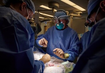 Primer trasplante de un riñón de cerdo modificado genéticamente a un paciente vivo en Estados Unidos