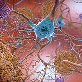 Un trasplante de médula ósea transmite el alzhéimer a ratones sanos