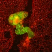 Así funcionan las neuronas de la memoria a corto plazo, claves en alzhéimer