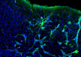 Neuronas en el cerebro