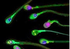 Un anticonceptivo masculino reversible desactiva los espermatozoides