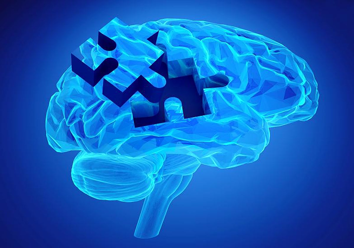 Donanemab se administra por vía venosa cada cuartro semanas