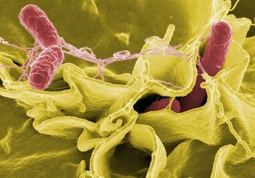 Asocian el autismo con una microbiota intestinal alterada en niños