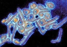 Qué es el virus de Marburgo y por qué es tan peligroso: síntomas, transmisión y recomendaciones