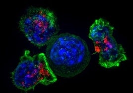 Un biomarcador  predice la respuesta a la inmunoterapia en el cáncer de hígado