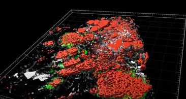 El atlas más completo del cáncer de mama, colon o páncreas explica cómo se expande