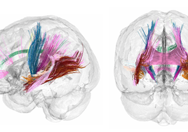 Este nuevo mecanismo del cerebro  renueva constantemente la memoria