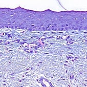 UGRSKIN: la primera piel artificial humana diseñada en España