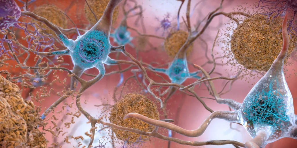 13 Proteins Linked to Brain Aging Identified