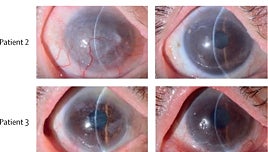 Los 10 principales avances médicos de 2024 y para 2025