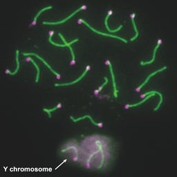 Descubren el papel de los genes del cromosoma Y en la fertilidad masculina