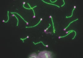 Descubren el papel de los genes del cromosoma Y en la fertilidad masculina