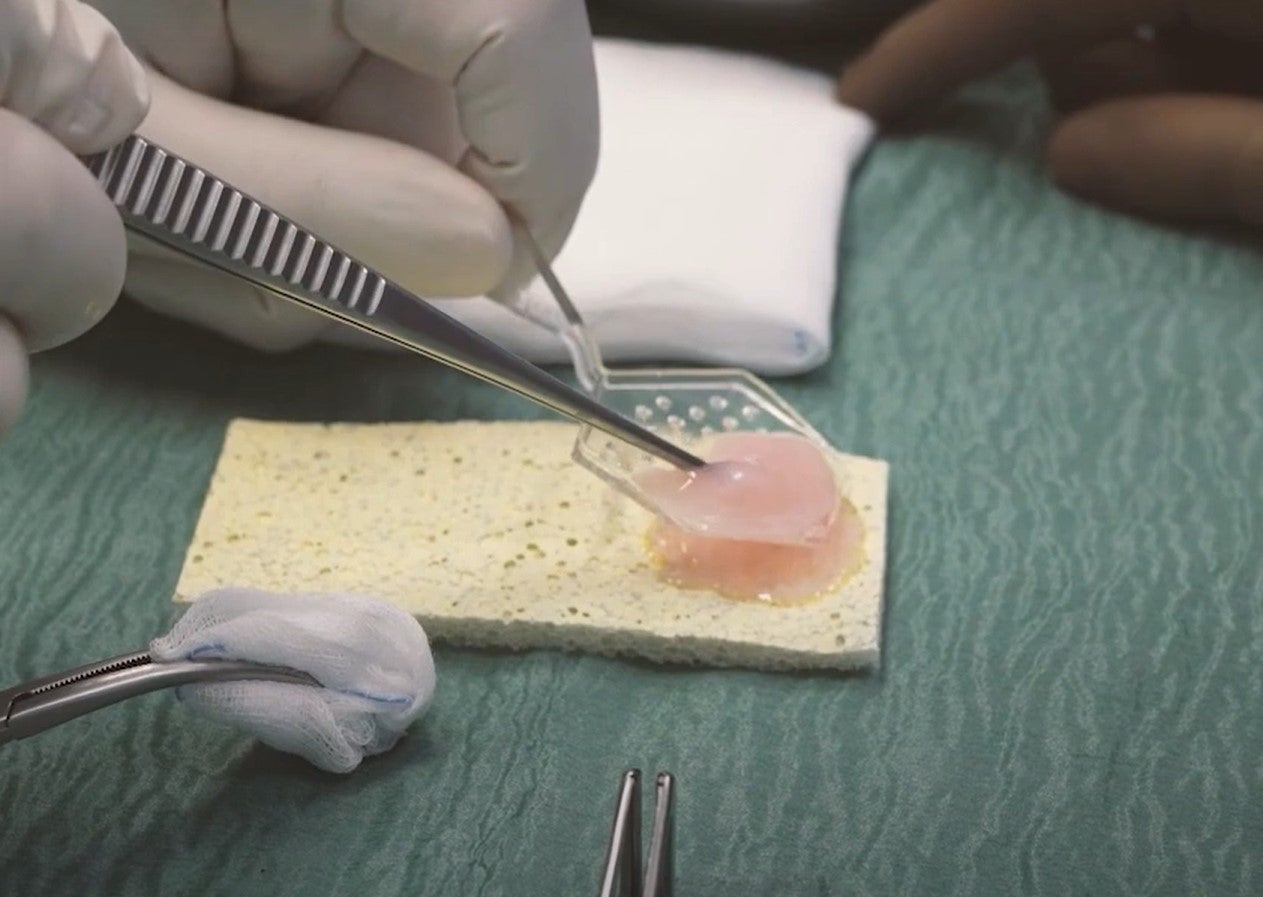 Fabricación del parche en el laboratorio