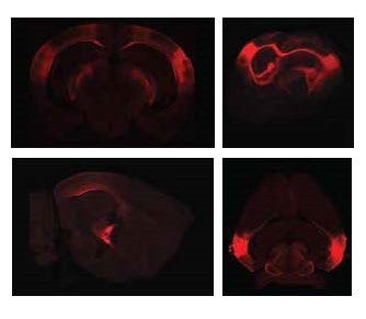 Vistas coronal, 3D, sagital y superior de secciones cerebrales que muestran las proyecciones de áreas visuales superiores al núcleo geniculado ventrolateral.