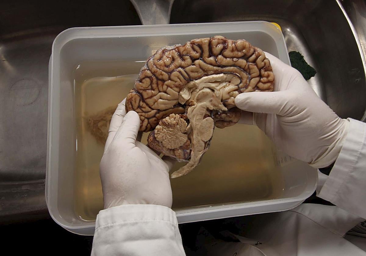 Un científico sostiene un cerebro.