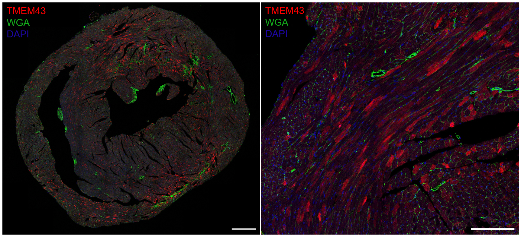 Expresión del vector terapéutico en el corazón del ratón, mostrando que la proteína TMEM43 se incorporó correctamente en las células cardíacas.