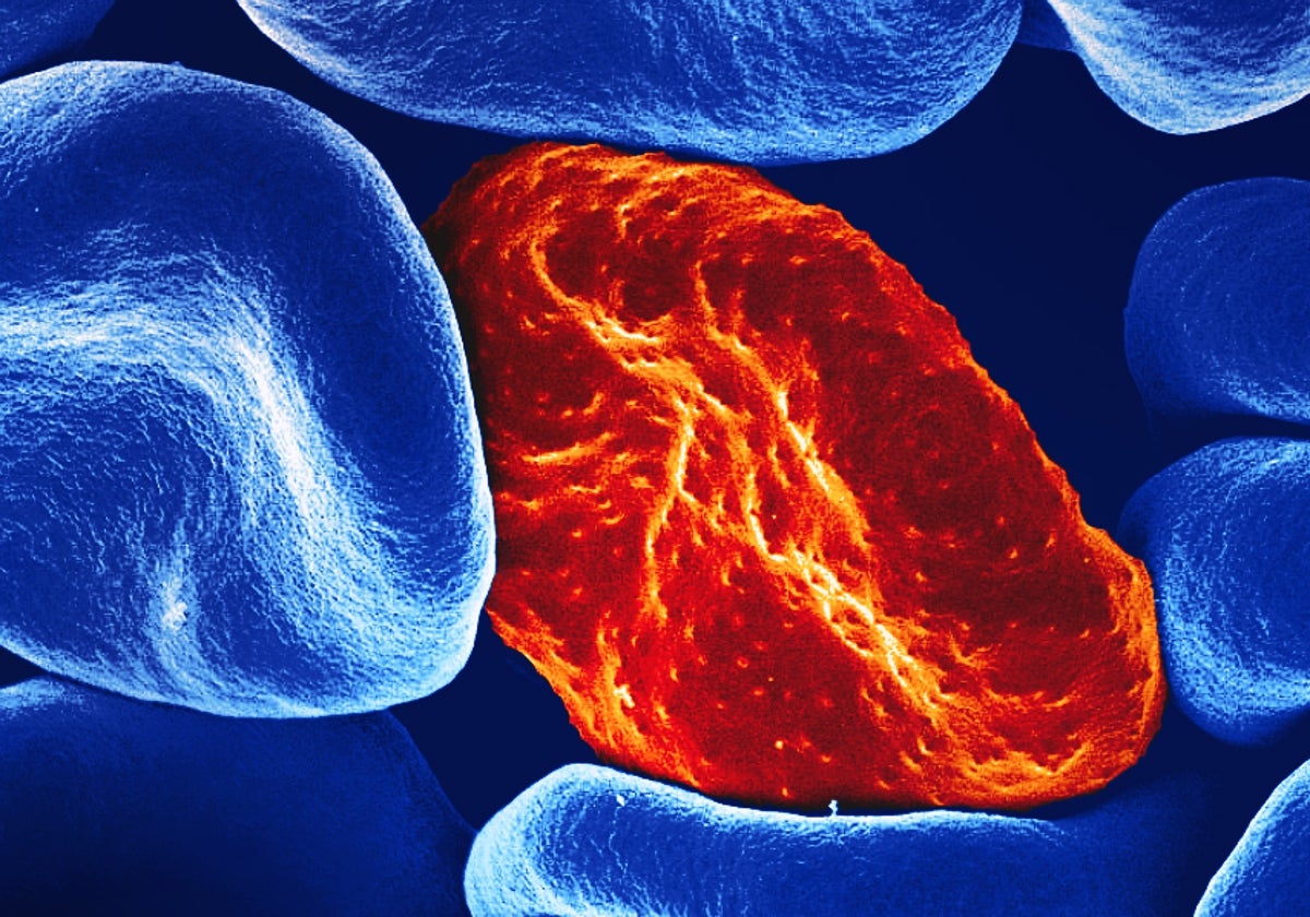 Células infectadas por el parásito de la malaria
