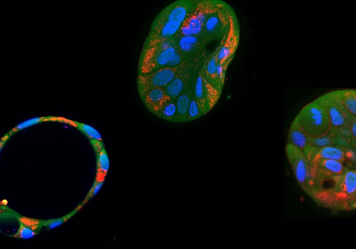 Organoides hepáticos derivados del paciente y sus mitocondrias (rojo)