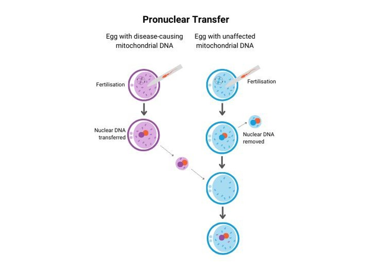 Así se realiza la transferencia pronuclear