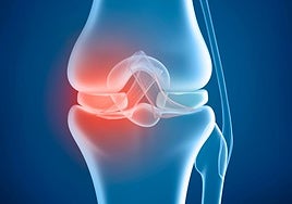 ¿Por qué nos crujen los huesos? Los fisioterapeutas lo explican