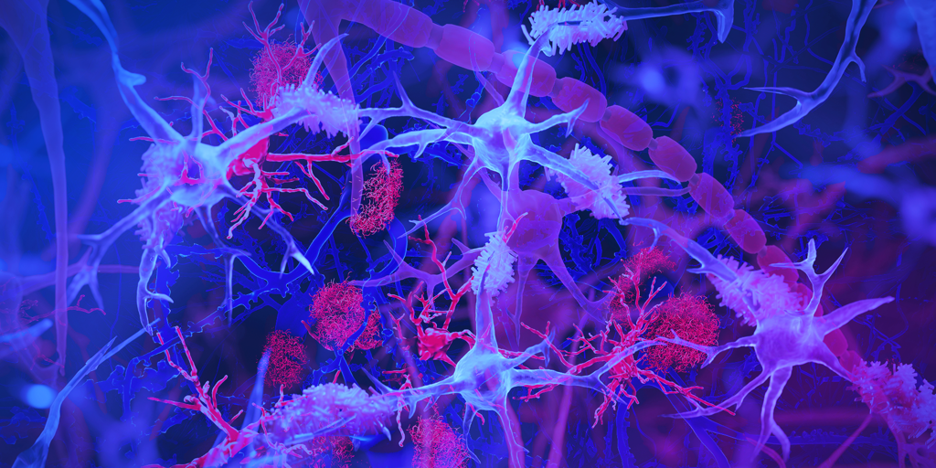 Un estudio explica el papel del intestino en el riesgo de alzhéimer y párkinson