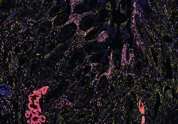 Un microbioma intestinal estable favorece el crecimiento infantil