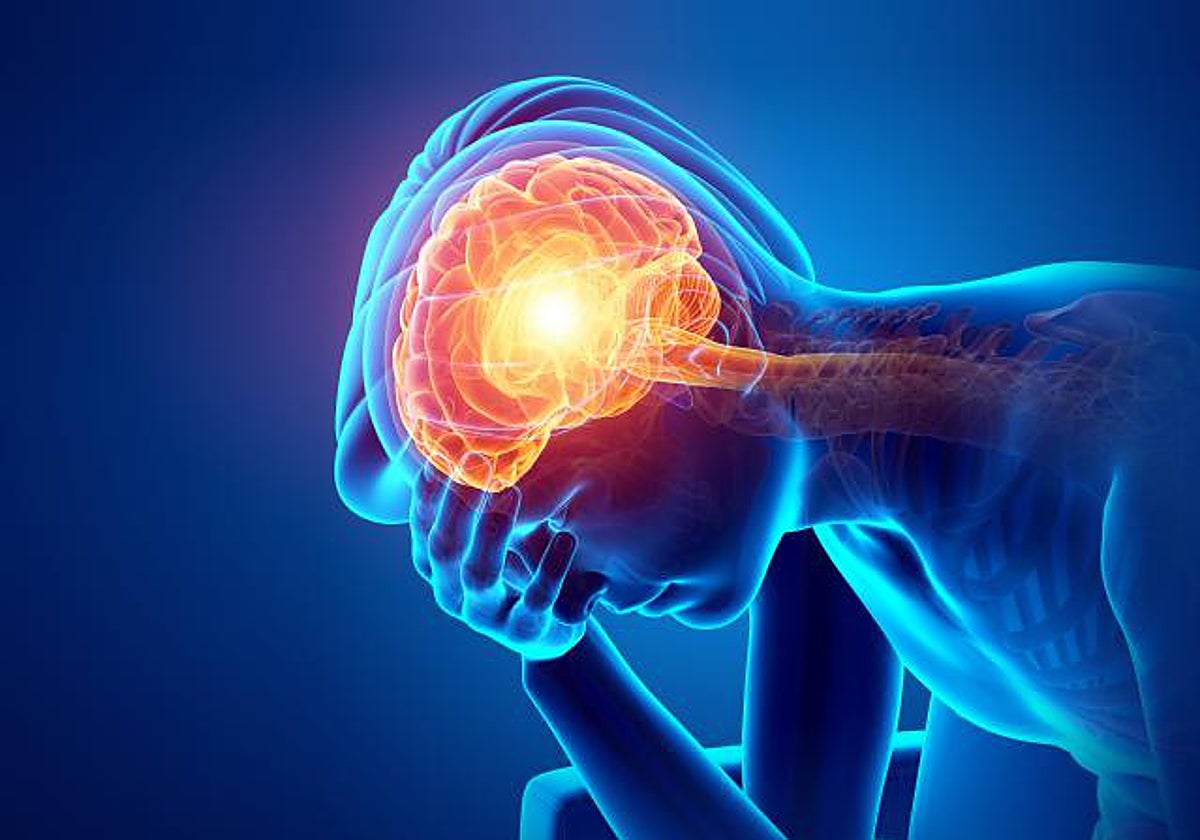 El 80% de los pacientes con migraña son mujeres