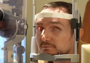 Un joven de 34 años recupera la visión gracias a un implante de diente en el ojo
