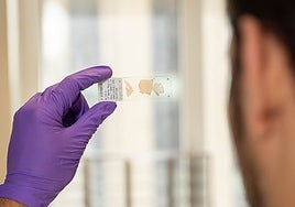 Un único fármaco podría ser una terapia casi universal para una enfermedad rara