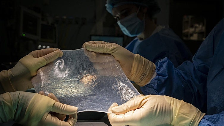 El primer trasplante de un hígado de cerdo a un paciente vivo permite que sobreviva más de medio año