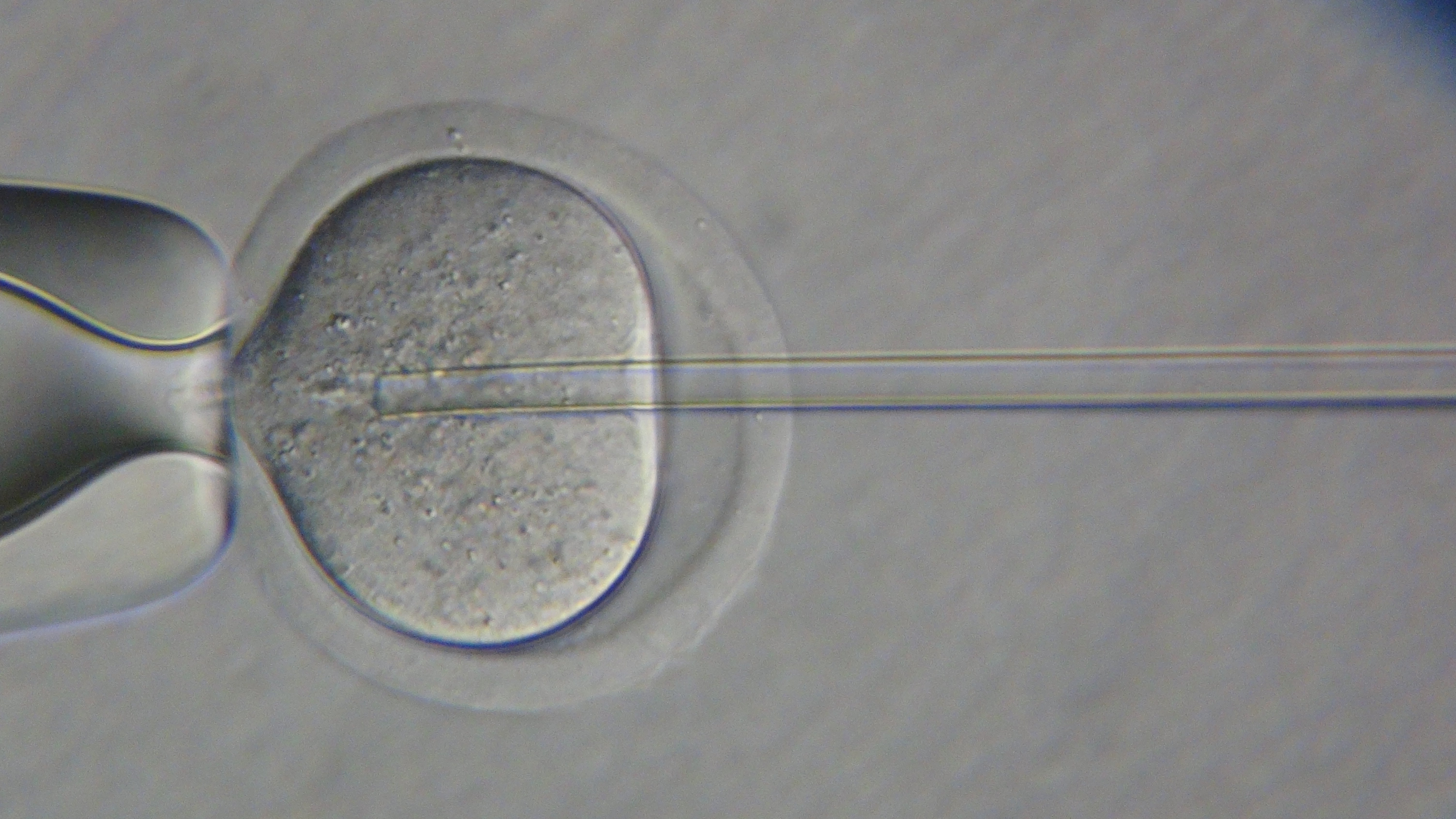 Inyección intracitoplasmática de espermatozoides.