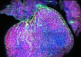 Este mapa explica cómo es corazón humano durante el desarrollo prenatal