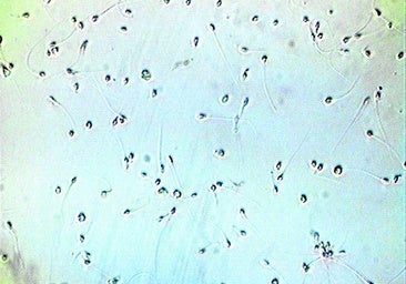 La IA logra un embarazo imposible tras detectar los dos únicos espermatozoides viables de un hombre