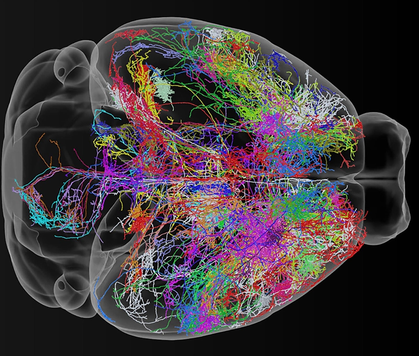 Conexiones cerebrales