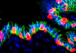 Células del estómago reprogramadas producen insulina para tratar la diabetes