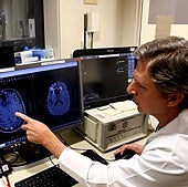 Visualización del uso de ultrasonido enfocado para abrir la barrera hematoencefálica y administrar quimioterapia.