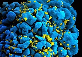 Una inmunoterapia controla el VIH durante meses en 7 personas sin fármacos