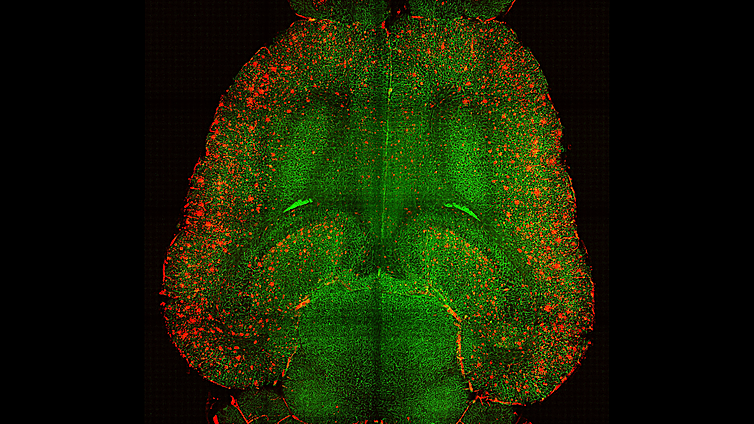 Si tienes ganas de encender un cigarrillo después de un café es por culpa de esta proteína