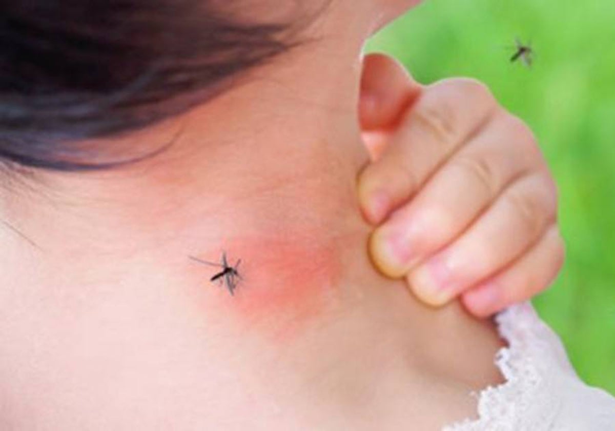 Un mosquito pica en el cuello de una persona