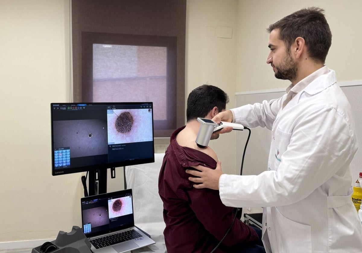 Luis Ortega Berbel, dermatólogo del Hospital Quirónsalud Infanta Luisa, con un videodermatoscopio de última generación