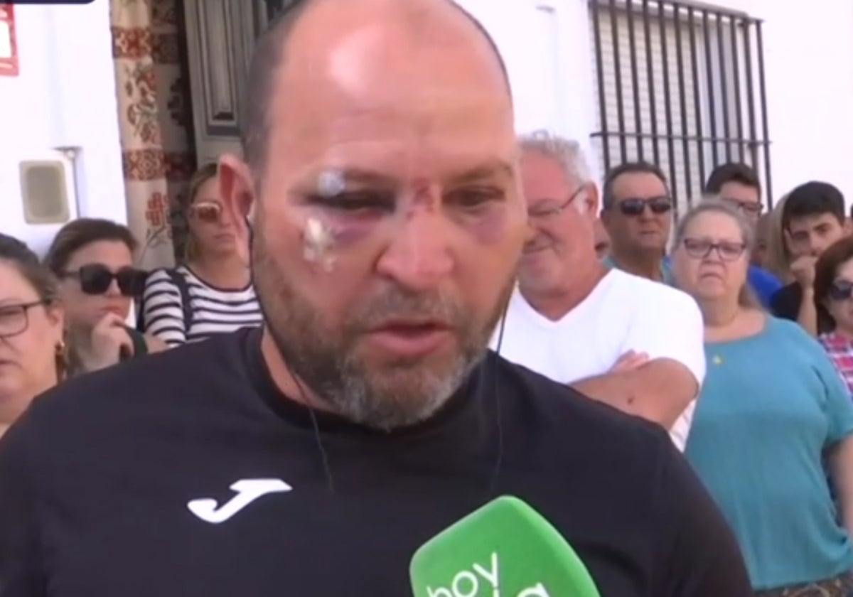Alejandro, el vecino de Villaverde que ha sufrido la agresión, atiende a los micrófonos del programa de Canal Sur 'Hoy en día', que conduce la periodista Toñi Moreno