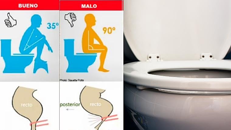 Postura correcta para prevenir el estreñimiento